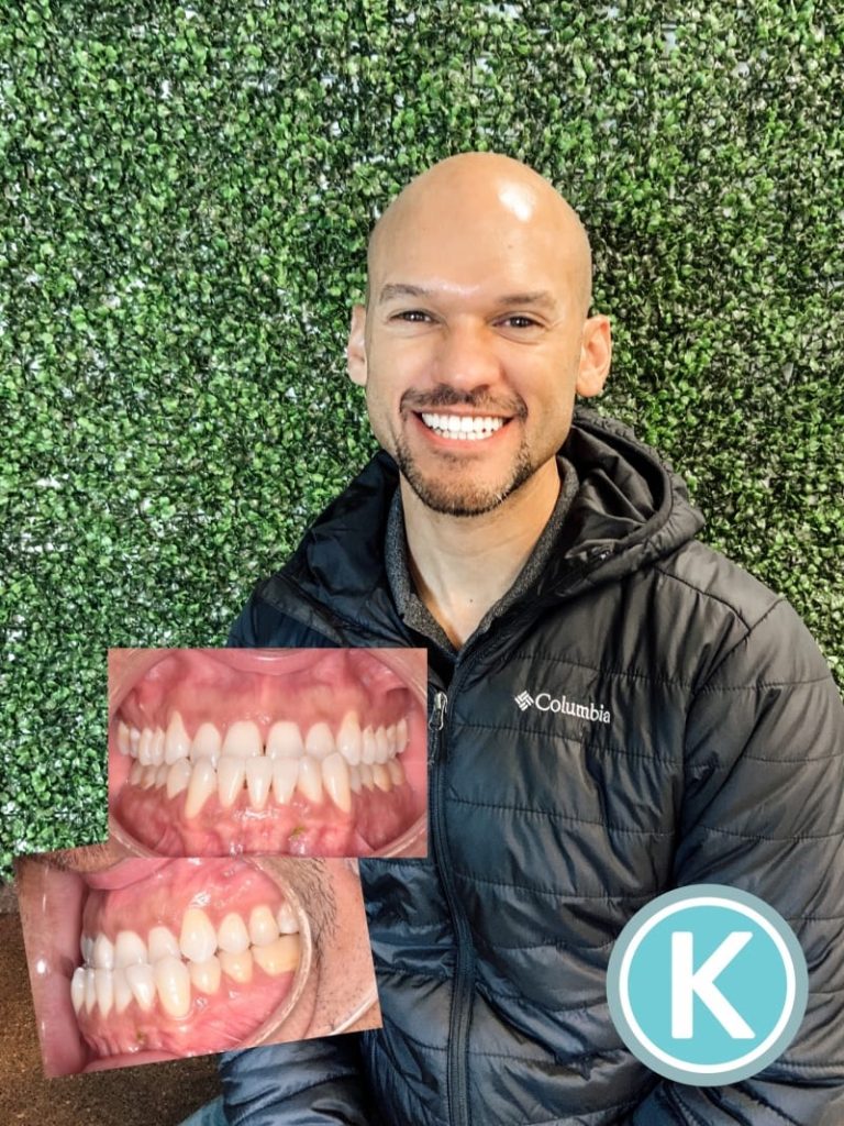 Patient398kragorortho scaled e1612811029567