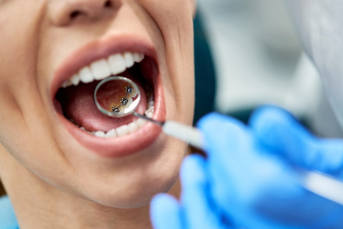 Can orthodontic treatment help with tmj disorder what the research and experts say blog