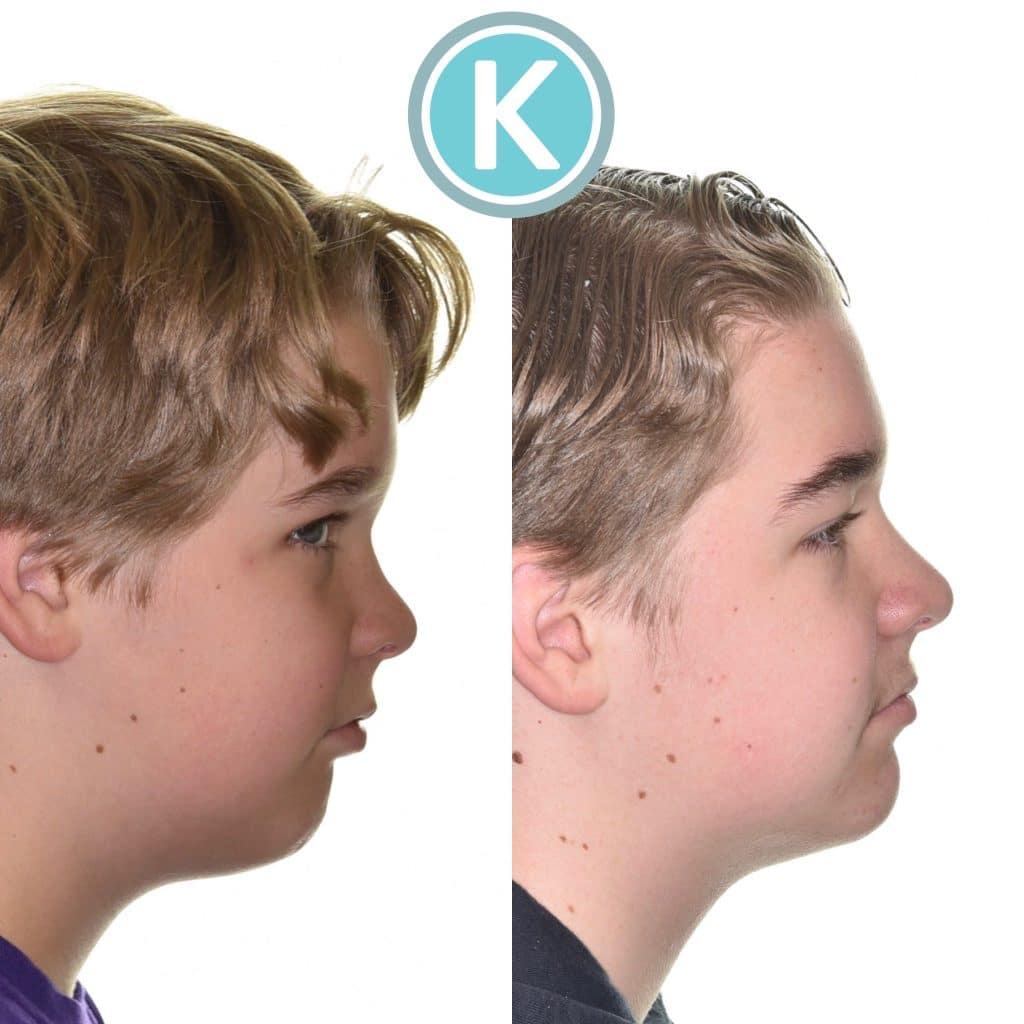 Kragor ortho patient 8733
