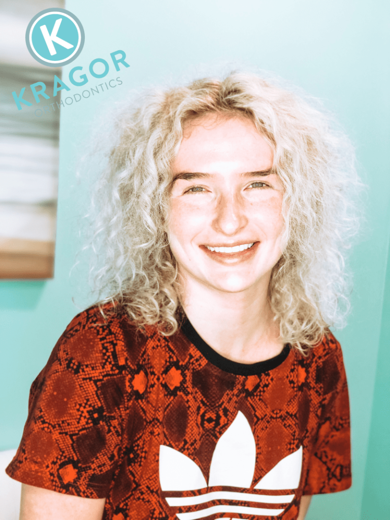 Kragor orthodontics patient 01 e1612811188398