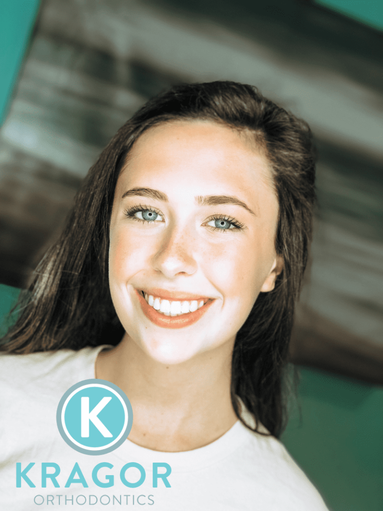 Kragor orthodontics patient 02 e1612811176255