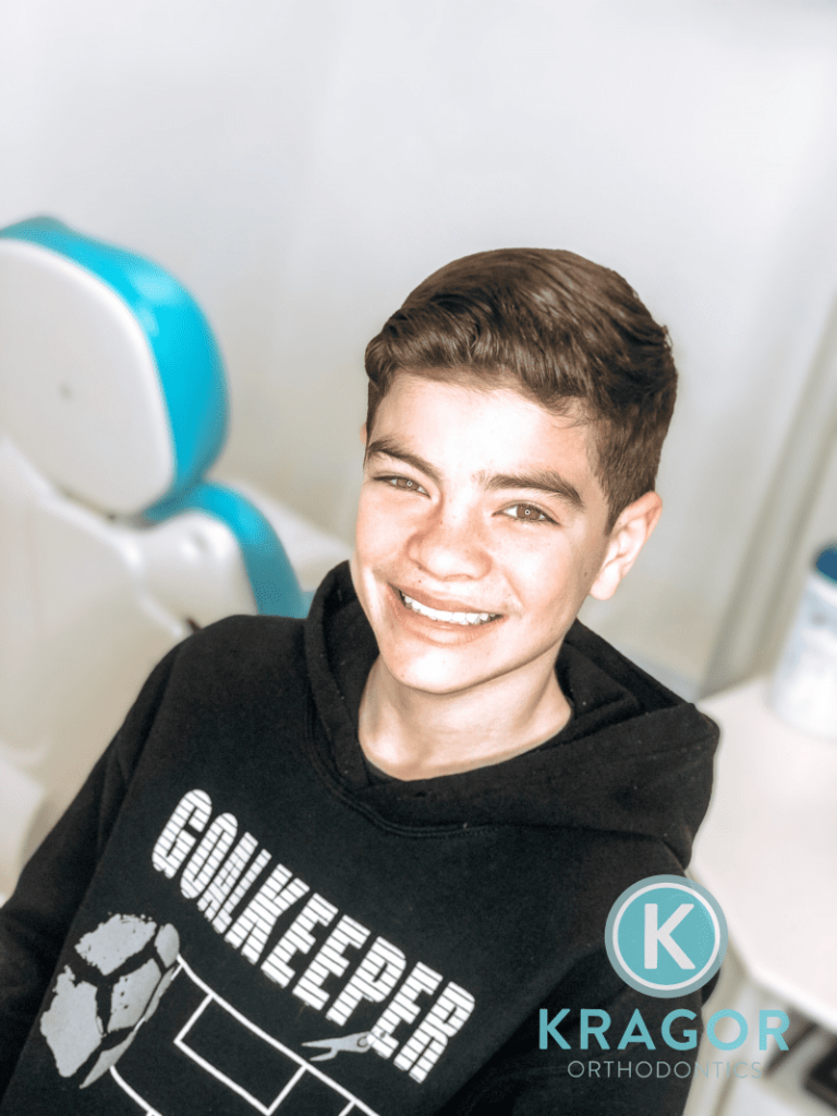 Kragor orthodontics patient 06 e1612811116597