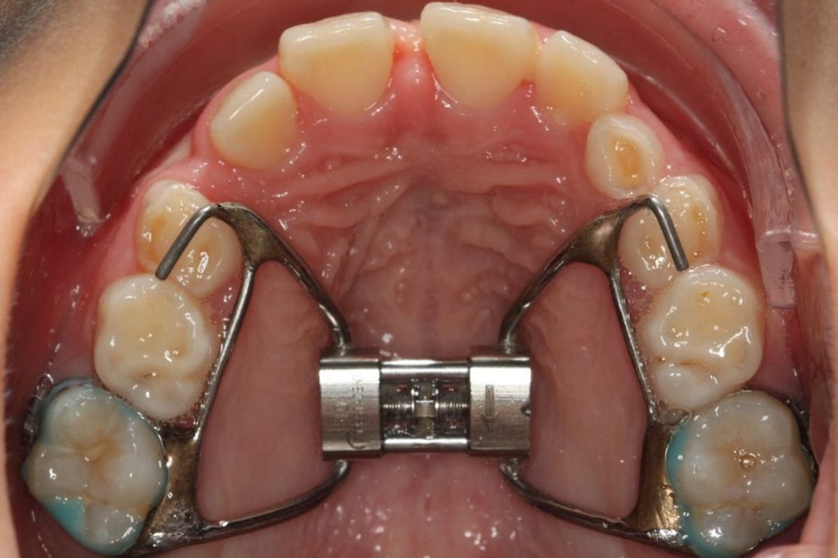 Why orthodontists love blog